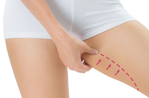 inner thigh